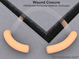 Image result for Corner Stitch