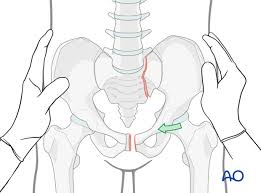 Image result for Pelvic Compression Test