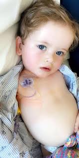 Boy who didn't like hair being brushed actually had leukaemia