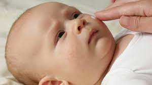 Rashes In Kids An Age By Age Guide To Children S Skin Conditions