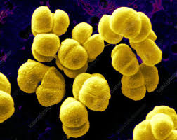 Examination of bacterial cells with electron microscope reveals various component structures. Sarcina Stock Image B220 1594 Science Photo Library
