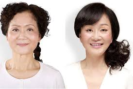 20 Chinese Women Before And After Plastic Surgery Plastic Surgery Cosmetic Surgery Laser Freckle Removal
