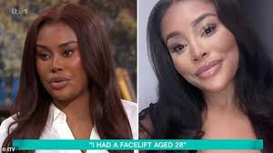 I sweated THREE LITRES a day due to rare health condition that saw me  bullied by cruel kids who said I 'didn't' wash