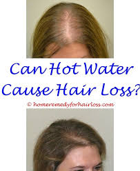 I had a few wiry ones poking out from my chin. Liletta Side Effects Hair Loss