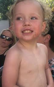 Sadie was born at Orlando Health Winnie Palmer Hospital for Women & Babies  with a Tetralogy of Fallot, a complex heart defect. She recently underwent  surgery for her condition at our hospital