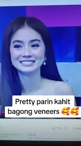 Transform Your Smile with Stunning Veneers Makeover