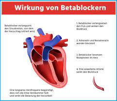 Jeder patient mit chronischer herzinsuffizienz sollte einen betablocker bekommen — aber nur, wenn sein herz im sinusrhythmus schlägt und seine ejektionsfraktion unter 50 % beträgt. á… Blutdruck Medikamente 2021 Betablocker Richtig Einsetzen