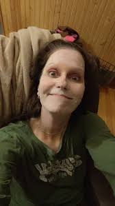 Did others use Noxzema for sunburns and skin care?