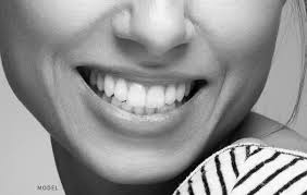So, my bottom teeth stick out further than the top, so it's kind of way off. Wisdom Tooth Extraction Desert Hot Springs Emergency Tooth Extraction