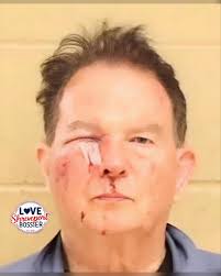 Update: On May 5, 2025, SPD Detectives went to Ochsner Health Hospital to  speak with the doctors to obtain additional information regarding the  victim's injuries. After speaking with the doctors and reviewing