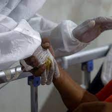 Der zeitpunkt zum ablichten hätte kaum günstiger sein können und es gibt nur sehr wenige bilddokumente dieser. Indien Schwarzer Pilz Zerfrisst Corona Patienten Premierminister Warnt Vor Weiterer Todlicher Krankheit Welt