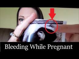It's common for a small percentage of pregnant women to have spotting after intercourse, for example, and others may have bleeding for reasons that have nothing to do with. Why I Was Bleeding 7 8 Weeks Pregnant Youtube