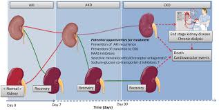 Image result for Postrenal Failure