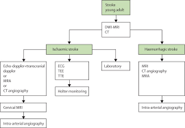 Aetiological Diagnosis Of Ischaemic Stroke In Young Adults