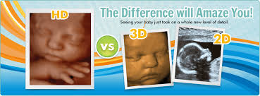 3d Ultrasound 4d Ultrasound Hd Ultrasound Lake Jackson Stork Shots