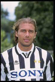 Antonio conte is set to hold talks with chelsea this week with a view to becoming the club's new manager next season and the italian underwent a hair transplant shortly after ending his playing career. Antonio Conte I Capelli Piu Discussi Del Calcio Estetica It