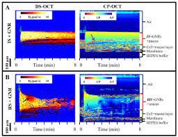 Enter either the youtube url or the video's specific id to create a custom duration clip from any youtube video of your choosing. Diffusion Sensitive Optical Coherence Tomography For Real Time Monitoring Of Mucus Thinning Treatments