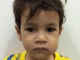 MANAGEMENT OF ACUTE OROFACIAL INFECTION OF ODONTOGENIC ORIGIN IN CHILDREN  (1st Edition)