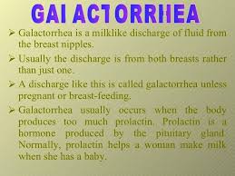 Image result for Galactorrhea