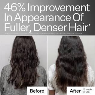 Peptide treatments yield denser, fuller hair growth，AI 生成