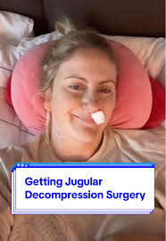 Mi experiencia con la cirugía de descompresión de la vena yugular