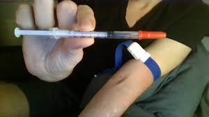 0.2ティナのスラムの後に角質になる