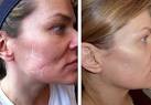 Tattoo Scar Cover Makeup -