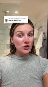 Barbara Oneill Basal Cell Carcinoma Stage 4