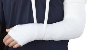 The Difference Between Bones That Are Broken Dislocated And Sprained