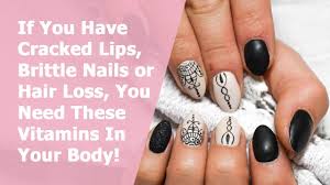 A deficiency in biotin is very. If You Have Cracked Lips Brittle Nails Or Hair Loss You Need These Vitamins In Your Body Youtube