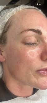 Good morning all, here at McIntyre Corbett and associates we are delighted  to welcome Dr Fiona Purss General Dental Council registration 152033 to  join our team here in Dingwall. She combines technical