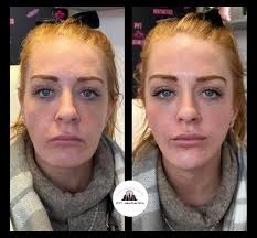 Girls I'm in need of a refresh mummy make over