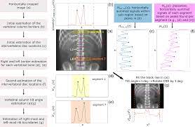 Bedroom set informatica tutorial point. Automatic Generation Of Three Dimensional Dose Reconstruction Data For Two Dimensional Radiotherapy Plans For Historically Treated Patients