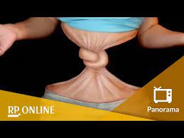 Knoten Im Bauch Youtube