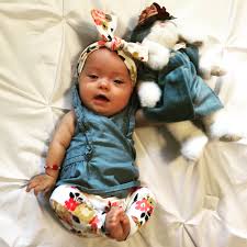 Photos Of Babies With Down Syndrome Popsugar Family