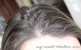 Rogaine is a topical medication applied directly to the scalp to help promote hair growth. My Secret To Thicker Hair Revisited My Newest Addiction