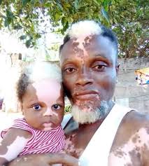 dna blo 9cty legend discussion