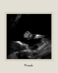 Image result for tbn:T5UajvfpShvp6M::www.photoslinks.com/index.php%3Foption%3Dcom_joomgallery%26func%3Dwatermark%26catid%3D4%26id%3D23%26Itemid%3D2