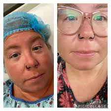 Experiencing side effects after weight loss shot