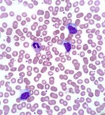 This infectious disease can be spread by saliva, and the incubation period for mono is four to eight weeks. Infectious Mononucleosis Definition And Meaning