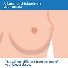 What does a benign breast lump feel like? Breast Cancer Symptoms Health Information Bupa Uk