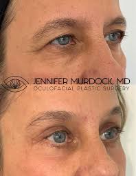 Image result for Blepharis involucrata