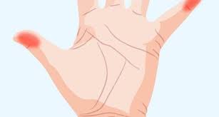 Orbitor partea 1 aripa stanga. Simti Furnicaturi In Degetele De La Mana Stanga Uite Ce Problema De Sanatate Ai Girly Ro