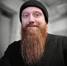 You're healing, he's balding; it's a beautiful day.