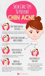 Chin Acne What Is It Causes And How To Get Rid Of It Chin Acne Chin Acne Causes How To Remove Pimples