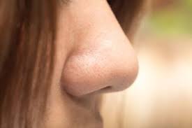 Not because it isn't beautiful (strong noses have been considered lovely for centuries) but because in our plastic… The Different Types Of Nose Shapes What S Yours Step To Health