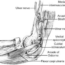 Ulnar nerve entrapmentat the elbow (cubital tunnel syndrome) and wrist (guyon's canal syndrome) occur due to repetitive compression, from leaning on the elbows or wrists (cyclist's palsy) and prolonged elbow flexion. 1 Potential Sites Of Ulnar Nerve Compression 1 Intermuscular Download Scientific Diagram