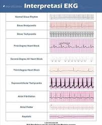 Maybe you would like to learn more about one of these? Interpretasi Ekg Suara Literasi Perawat Indonesia Facebook