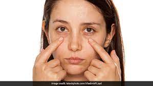 Makeup artist katie jane hughes reveals the brilliant hack she uses to pick the perfect color of undereye concealer for dark circles, discoloration, and more. 5 Natural Home Remedies To Remove Dark Circles Ndtv Food