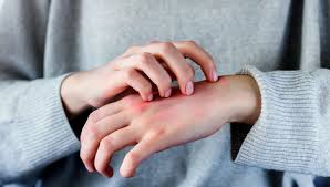 Image result for svrab na k%u016F%u017Ei